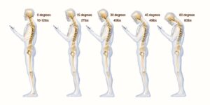 Smartphone problemas Smartphone problemas