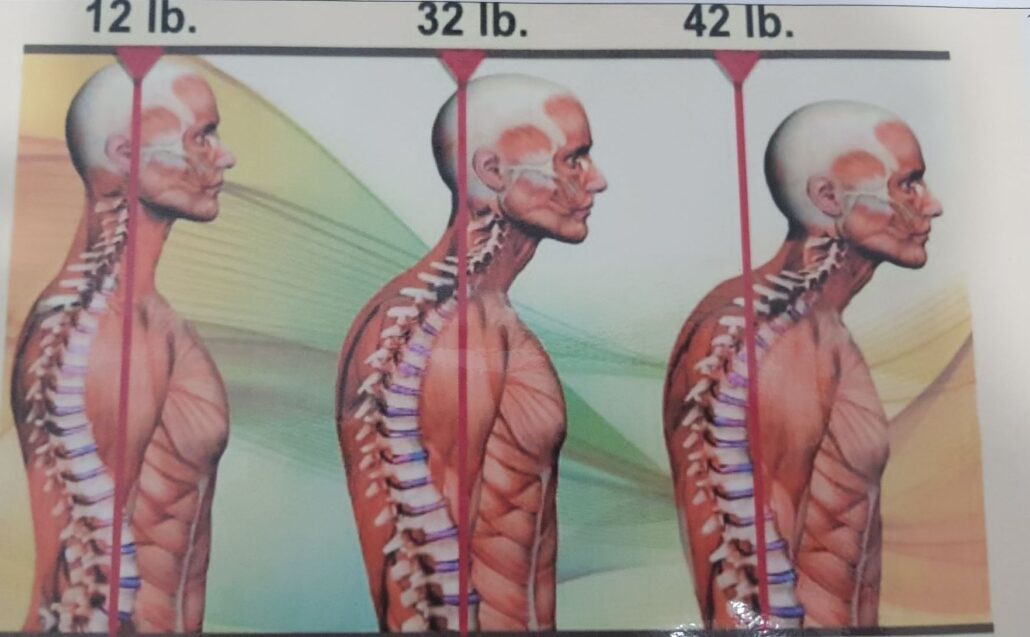 La inclinación de la cabeza aumenta el peso de esta sobre los hombros, causando graves problemas Peso que soportan nuestros hombros con la inclinación de cabeza