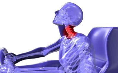 Esguince cervical o latigazo. Cómo superarlo con la quiropráctica.
