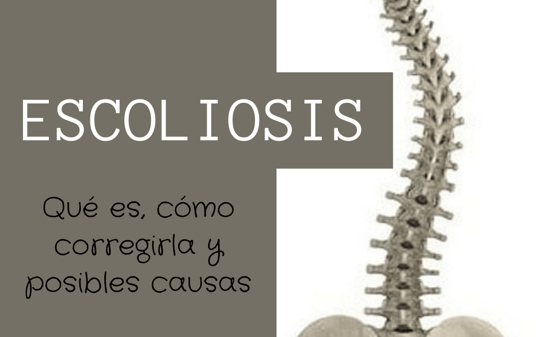 Escoliosis
