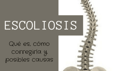 La escoliosis: qué es, cómo mejorarla y posibles causas.