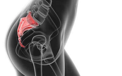 Dolor de coxis: Consejos para aliviarlo.