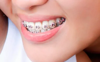 Braquets y quiropráctica: similitud entre los dientes y la columna